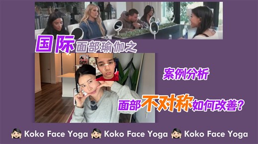 案例分析の面部不对称如何改善？