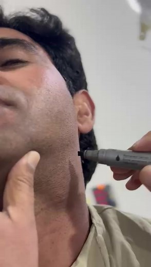 Buner Advance Thyroid Clinic: Your Health Partner
