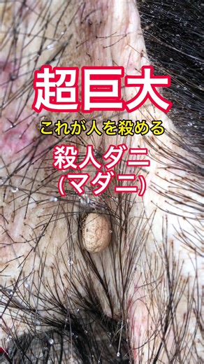 超巨大マダニ‼️ 人を刺すダニの危険性と正しい対処法