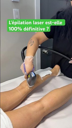 L'épilation laser est-elle 100% définitive ?