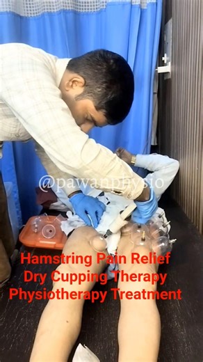 Hamstring Pain Treatment with Dry Cupping Therapy | Physiotherapy Muscle Recovery#painrelief