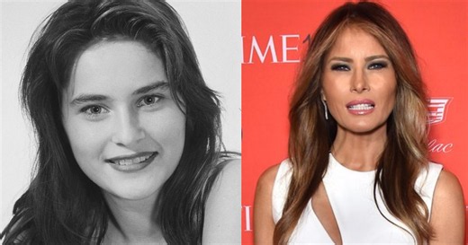 Plastic surgeon breaks down Melania Trump’s ‘very unnatural looking’ face changes’ massive price tag