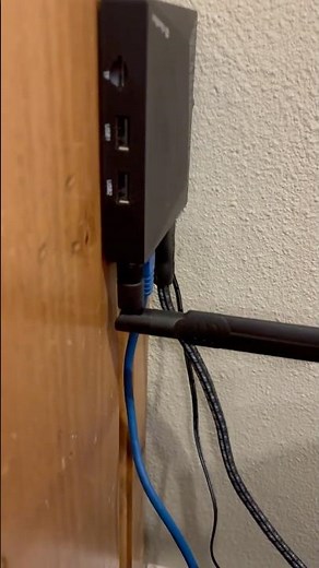 My vSee Box Ethernet Connection