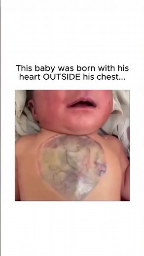 The RAREST Birth Defect You've NEVER Heard Of...