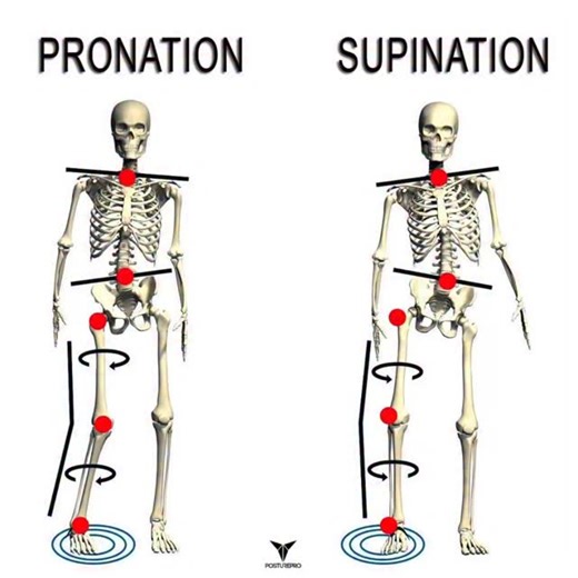 My 13 year old lacrosse player complained of ankle instability and lower leg pain. I had him do a Single Leg Stance (SLS) test and he oversupinated on both feet. Supination involves the tibialis anterior (TA) and tibialis posterior (TP), as well as the lateral thigh muscles. NKT testing found the TA overworking and the adductors underworking bilaterally. Released the TA and activated the adductors one side at a time. When we were done, his lower leg pain was much better, and his SLS was almost p