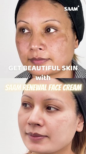 Get smooth skin - Stop worry about skin problems...