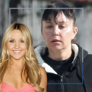 72K views · 433 reactions | What happened to #AmandaBynes' tender face?  Finally she revealed the truth.  | Icons | Facebook