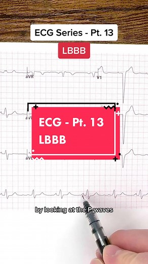 Discussing LBBB and its Impact on the Heart | Cardiology Chat