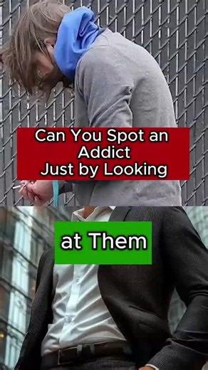 Why Do Addicts Look the Way They Do? (A Psychiatrist Explains) 🧠😱