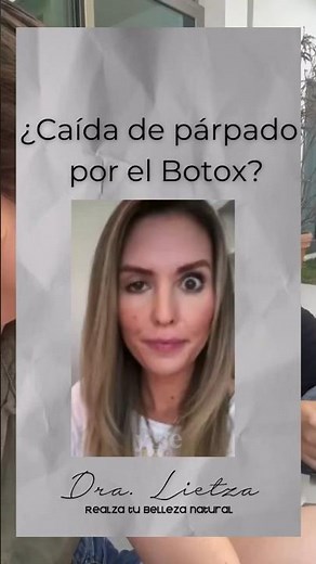 ¿Párpado caído por Botox ? #botox #parpadocaido #toxinabotulinica #dralietza