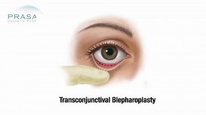 How to Treat Sagging Upper Eyelids, Under Eye Bags, and Wrinkles Around the Eyes