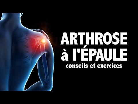 Arthrose à l'épaule: conseils et exercices