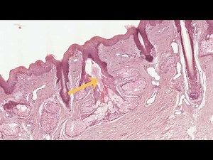 Simple Acinar & Simple Branched Acinar Glands