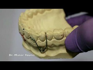 BUCCAL CANINE RETRACTOR