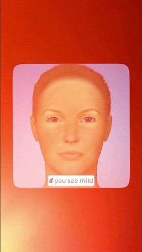 Why Is My Skin Peeling After a Chemical Peel? | Dermatologist Explains