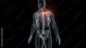 3D Rendering of a Medical Animation of the Collarbone. X-ray of the Collarbone.