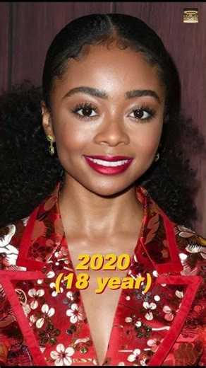 Skai Jackson Through The Years 2014–2026