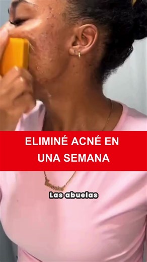 Jabón de Cúrcuma: Un Secreto Ancestral para tu Piel