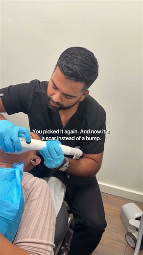 Picking a pimple causes more trauma than the breakout itself.