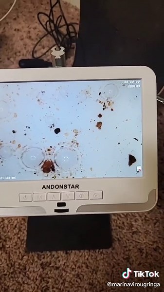 Exploring Snow under a Microscope