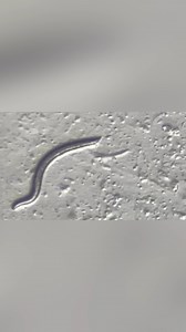 16K views · 136 reactions | 46,000-year-old ‘living’ parasite discovered in ice, ‘like the fairy tale of Sleeping Beauty’ | New York Post | Facebook