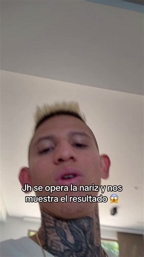 Es natural ? | la liendra