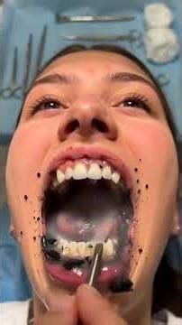 How AI is Changing Your Dental Visit 🦷 The Future of Same Day Teeth Fixes Dentix Dental Fix teethfix