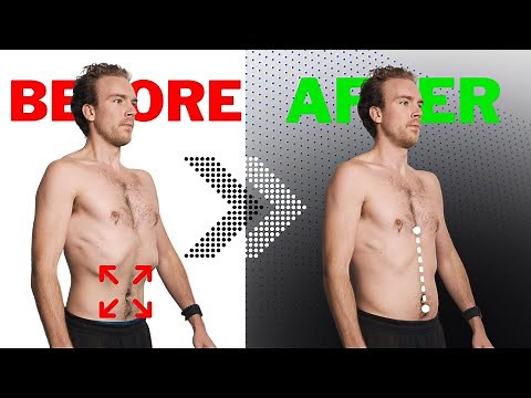 How To ACTUALLY Fix Your Rib Flare For GOOD