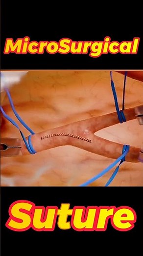 Precision Suturing in Microsurgery