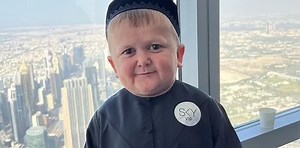 Qué es la acondroplasia, la enfermedad que sufre Hasbullah Magomedov