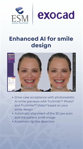 🚀 Introducing Exocad DentalCAD 3.3 Chemnitz