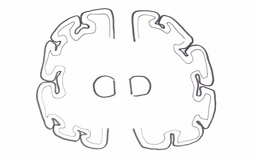 【双语】药理学 非甾类抗炎药（NSAIDs）@阿尔法小分队科教组