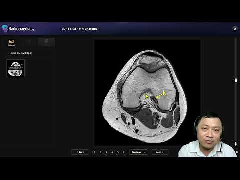 30- 2- MRI Knee Anatomy