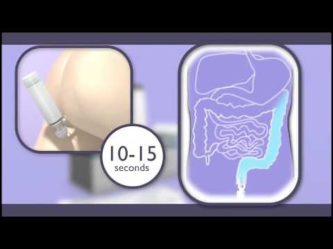 Rectal Treatment for Inflammatory Bowel Disease