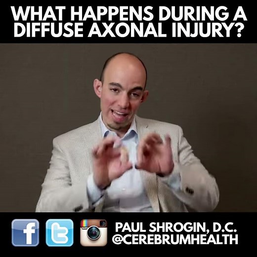 What happens during a diffuse axonal injury?