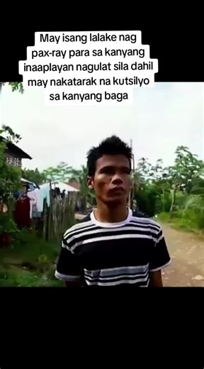 Man Surprised by Knife Found in Chest During X-Ray