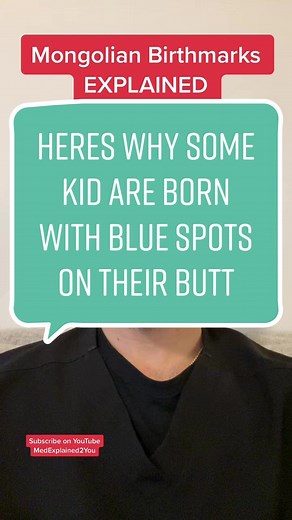 Understanding Mongolian Spots on Your Child's Butt