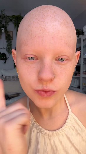 3.9K views · 6.3K reactions | Do I look like I have more freckles...