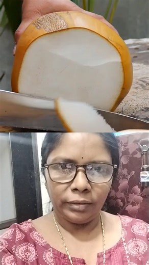 Tender Coconut Cutting Skills 👍 കരിക്ക് 😍#coconut #cuttingskills #ytshort #shorts #yt