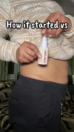 Effective Stretch Mark Removal Serum for Body Care