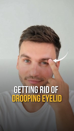 Dr Ales Ulishchenko MD PhD - Integrative Doctor|Osteopath|Healer on Instagram: "🔥 Remove drooping eyelids and open your eyes without surgery? IT’S POSSIBLE Follow this easy technique that I show on the video 👌🏻 do this everyday and you will see first results after a week 🚀 ❗️ Do you want me to publish more effective techniques for drooping eyelid? Leave 🔥 emoji in comments ⬇️"