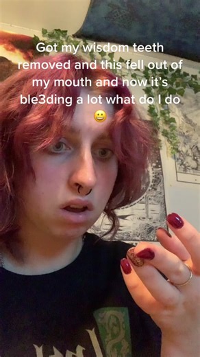 Wisdom Tooth Extraction Recovery: Bleeding, Clots, & Bruising