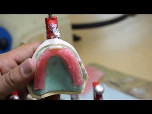 Complete denture technology 2 PRS352 ( Anterior teeth Setting)