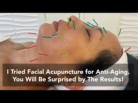 Look Younger Naturally: Dr. Erin Lee’s Holistic Approach to Ageless Skin with Facial Acupuncture