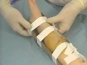 59 reactions · 86 shares | Cook intraosseous needle insertion. | Importance of pediatrics | Facebook