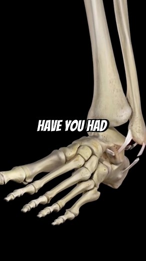 How to Fix Ankle Sprain for Better Mobility