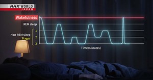 Capturing Awakenings for Better Sleep - Medical Frontiers