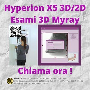 Hyperion X5 3D2D Esami 3D Myray #blindgroup #Myray #Hyperion #X5 | Blind Group | Facebook