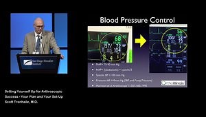 Setting Yourself Up for Arthroscopic Success - Your Plan and Your Set-Up