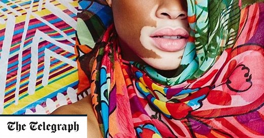 Winnie Harlow, the model changing the face of fashion